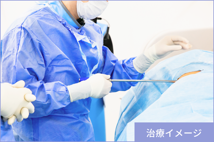 治療のイメージ